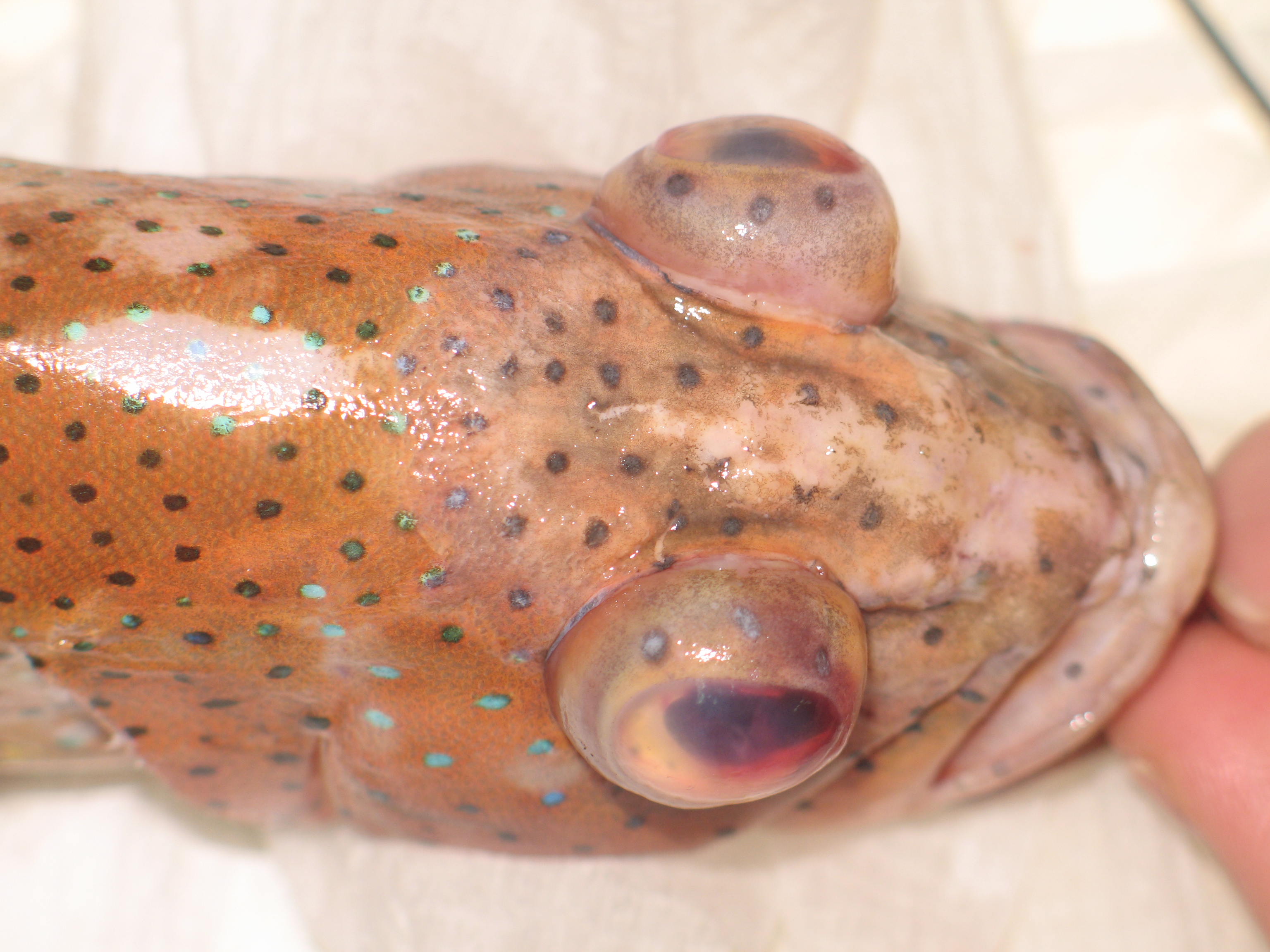 Exophtalmie